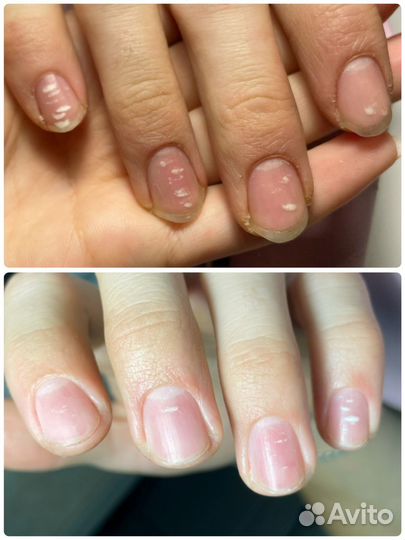 Маникюр, наращивание ногтей