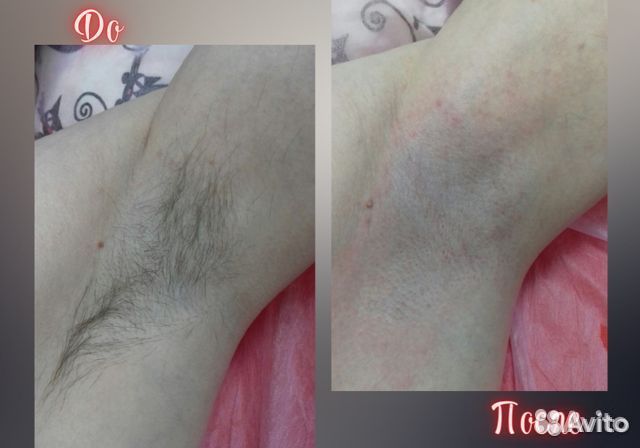 Мужской шугаринг