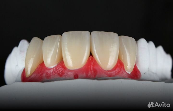 Зуботехническая лаборатория Моделирование Exocad