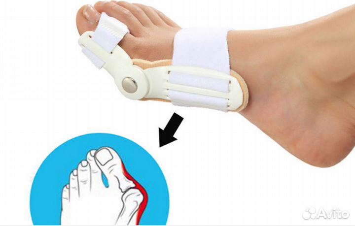Вальгусная шарнирная шина для выпрямления пальцев