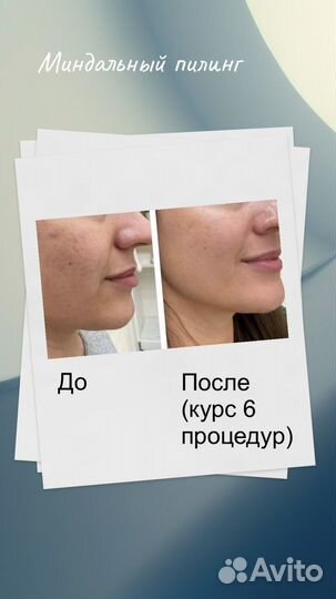 Услуги косметолога