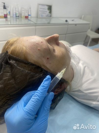 Биopeвитaлизaция