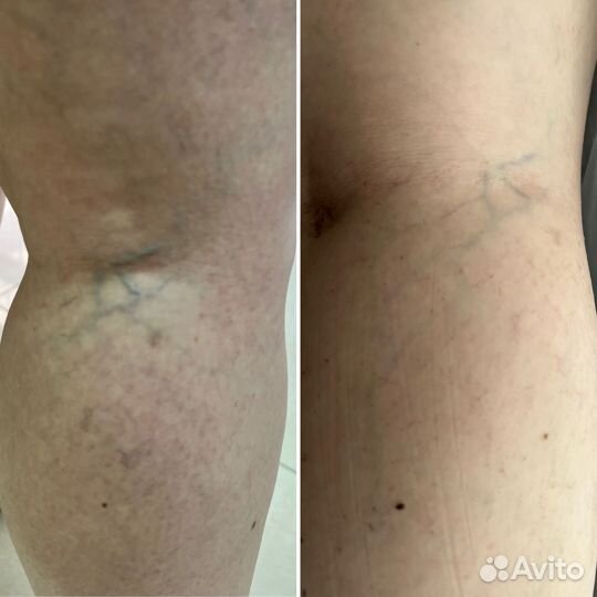 Водоросли ламинария и фукус