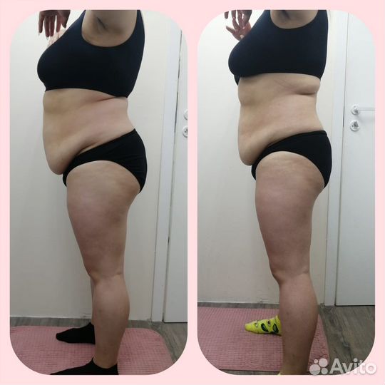 LPG Вакуумно-баночный Антицеллюлитный массажи