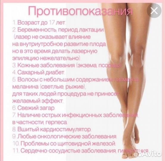 Лазерная эпиляция