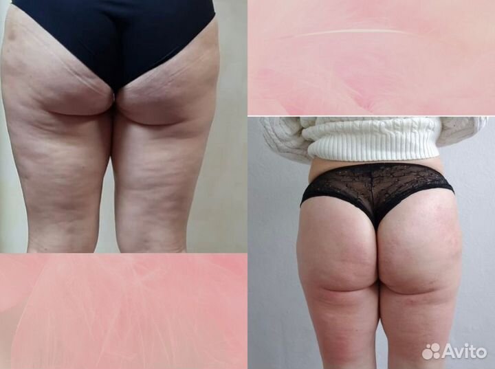 Массаж / Аппаратный массаж / Услуги косметолога