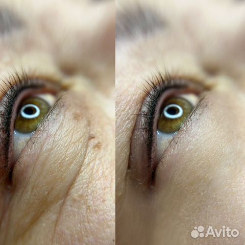 Обработка/ретушь фотографий/коллаж