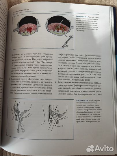 Пескатори Марио Аноректальная хирургия