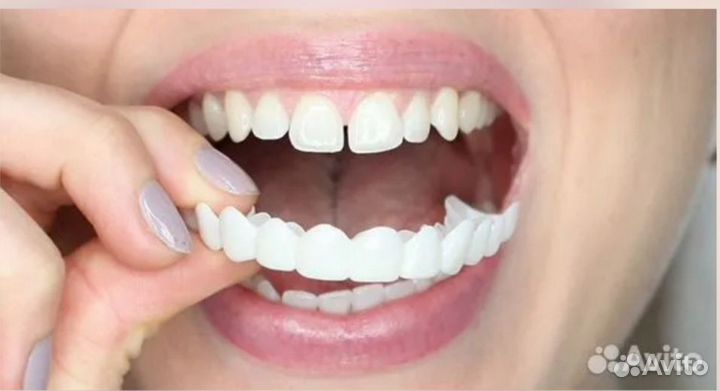 Съемные виниры Snap-On Smile