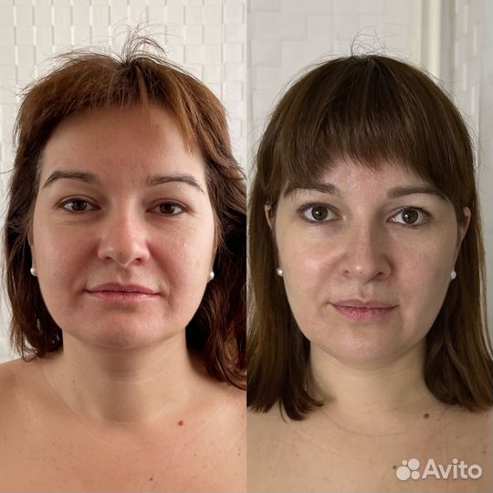 Массаж лица