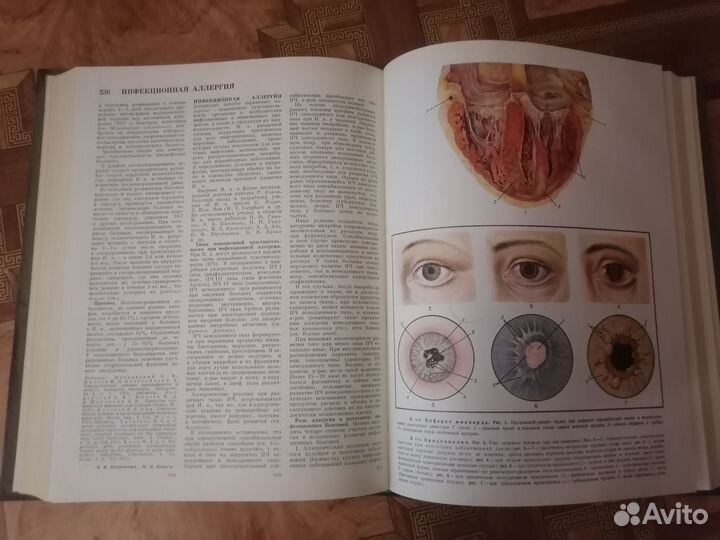 Большая медицинская энциклопедия, бмэ