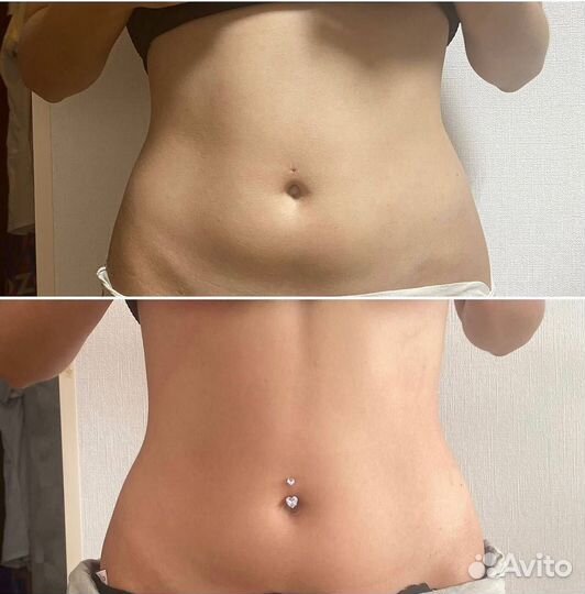 Липолитики, худое лицо, худое тело