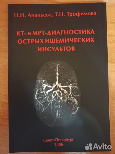 Кт и мрт диагностика острых ишемических инсультов