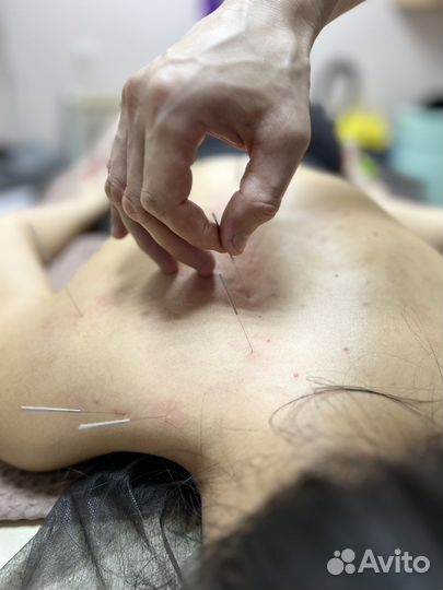 Миофасциальный лечебный массаж-Миопрессура