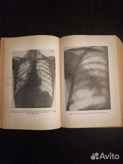 Учебник диференциальной диагностики. М. Маттес