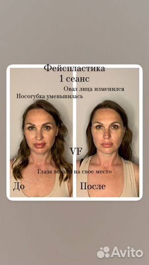 Массаж/ Фейспластика