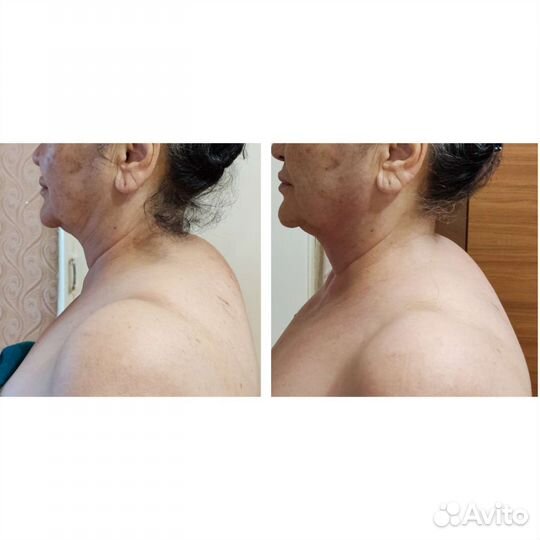 Массаж лица через тело