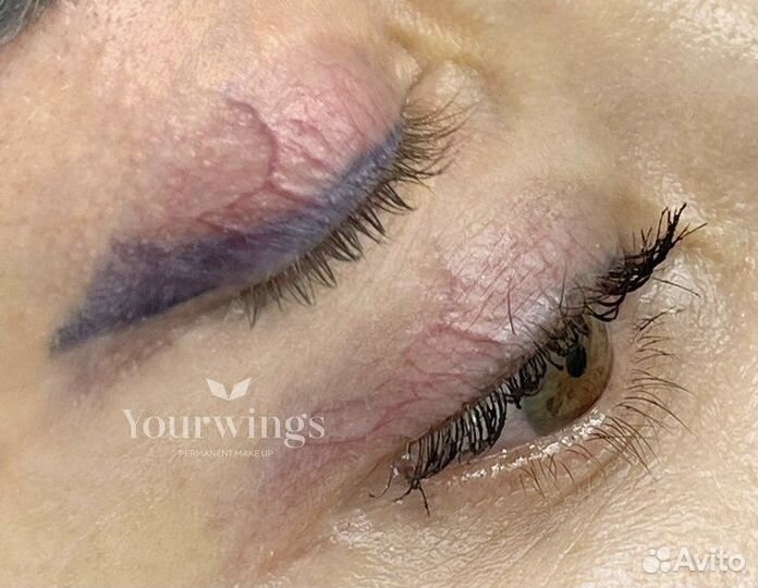 Удаление татуажа ремувером