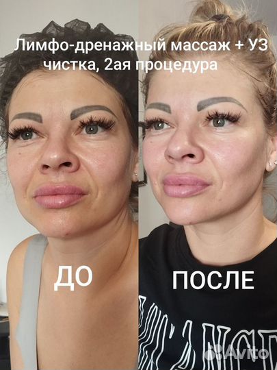 Услуги косметолога