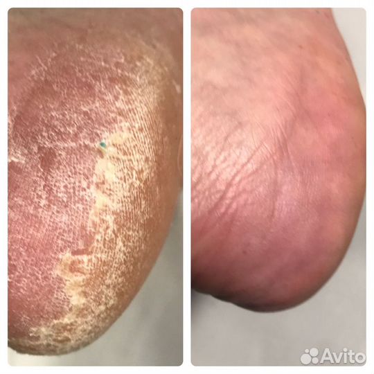 Маникюр/педикюр Дыбенко 17