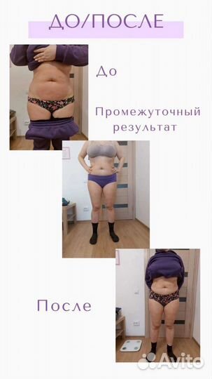 Криолиполиз