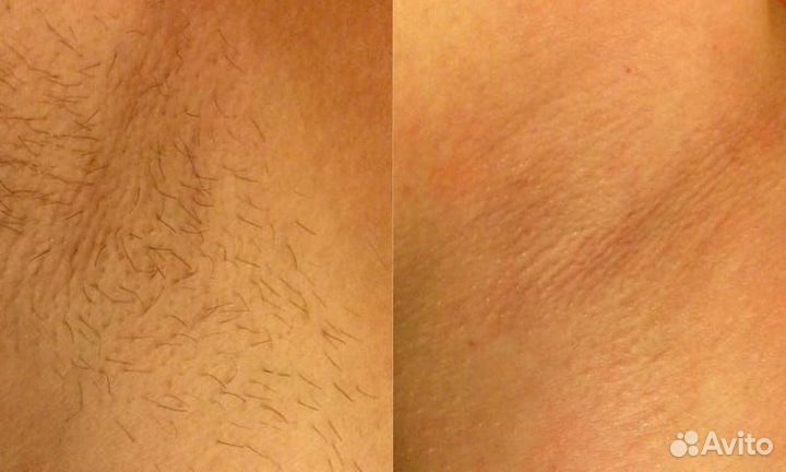 Мастер шугаринга