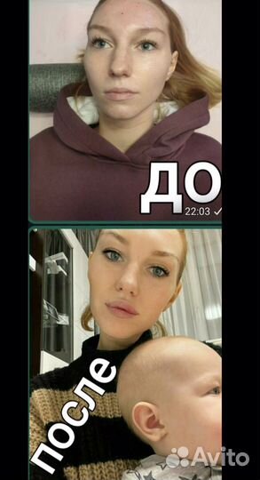 Массажист косметолог