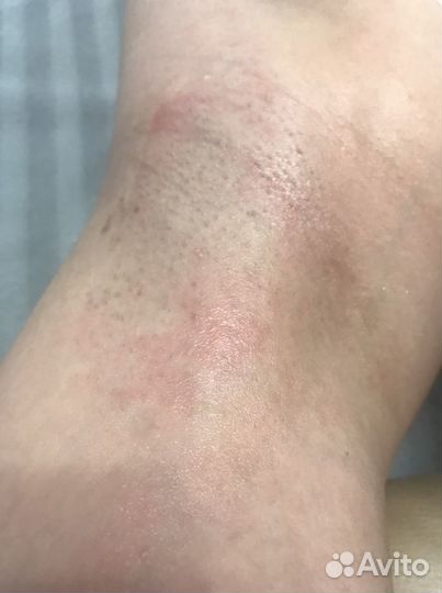 Восковая депиляция