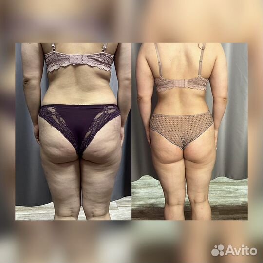 2часа(4процедуры) аппаратных процедур