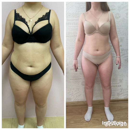 RET кавитация