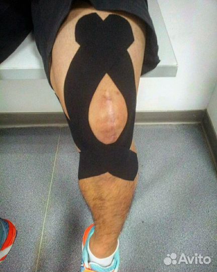 Тейпирование/Кинезио/Лфк/Реабилитация