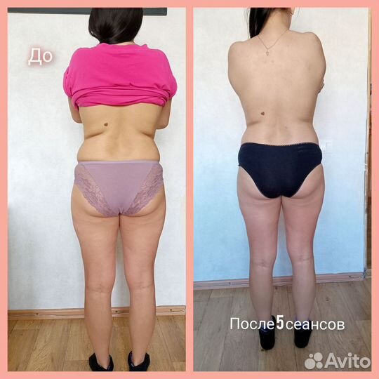 Услуги массажа на дому