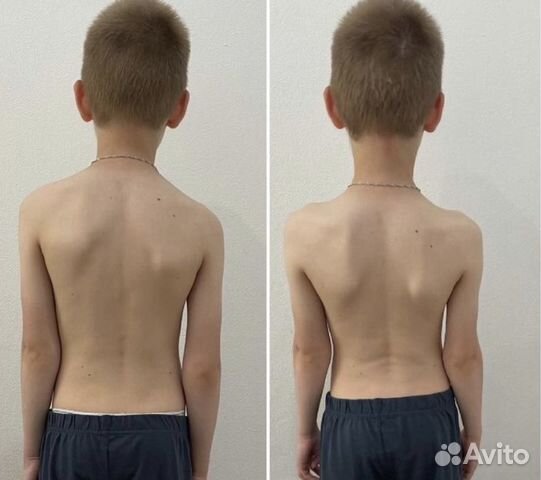 Детский массаж