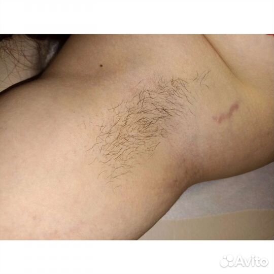 Шугаринг женский /мужской