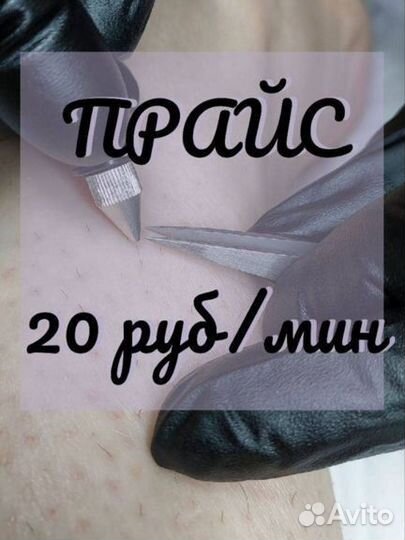 Электроэпиляция