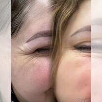 Косметолог, удаление тату, ботокс, увеличение губ, Видное