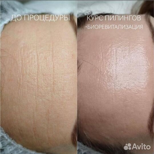 Услуги косметолога