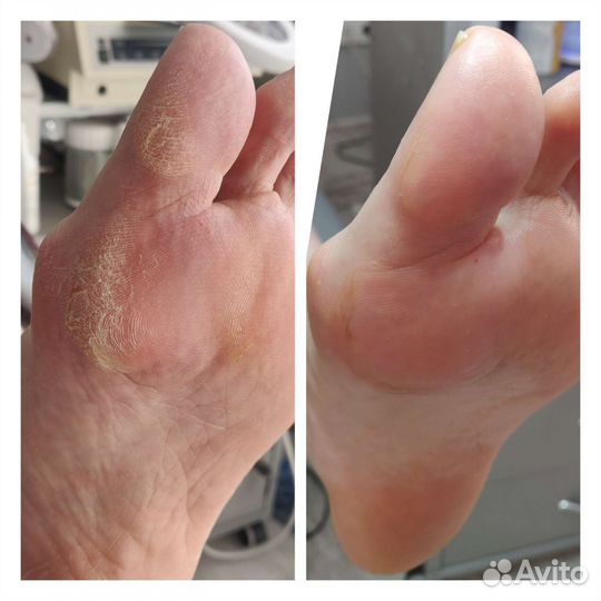 Подолог Московский р-н