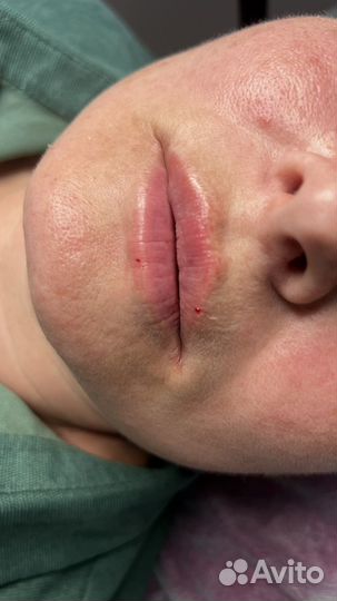 Косметолог иньекцыонист