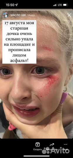 Взбитое масло Ши крем заживляющий