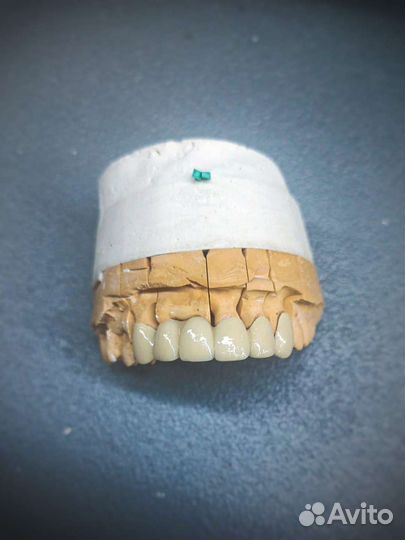 Зубной техник керамист