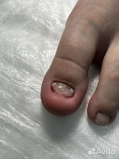 Подолог с выезжом на дом