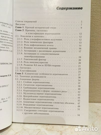 Кератоакантома