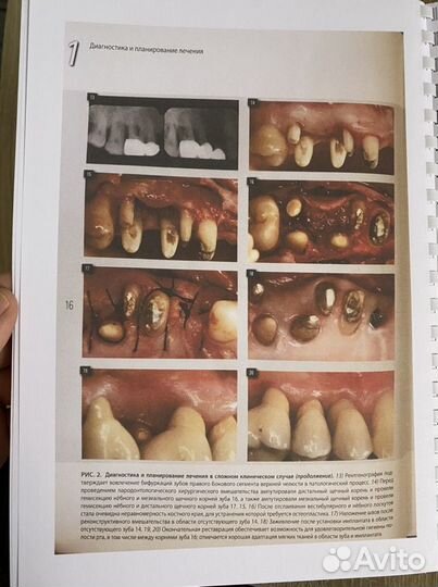Диагностика и лечение заболеваний пародонта