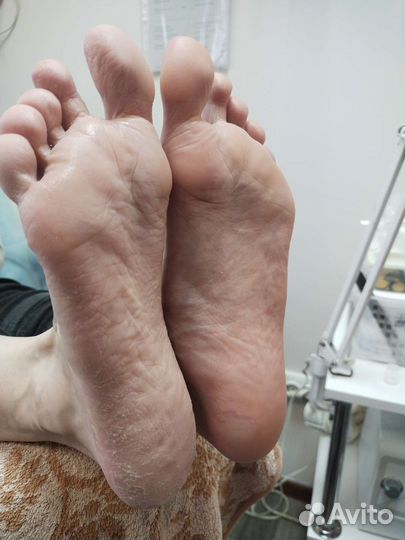 Услуги подолога