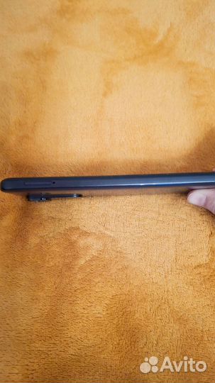 Xiaomi Redmi Note 11S, 6/128 ГБ