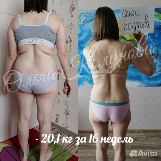 Похудеть на 5кг-7кг-15 кг, Диетолог, Целлюлит