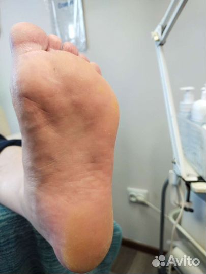 Услуги подолога