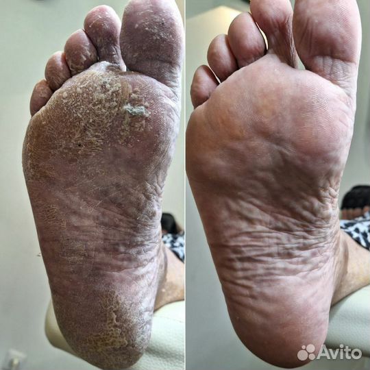 Подолог с медицинским образованием