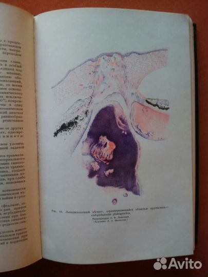 Опыт советской медицины в ВОВ 1941-1945 гг